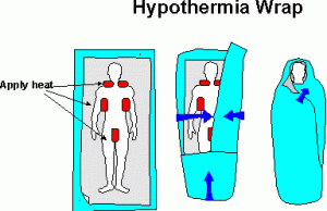 hypothermia-wrap